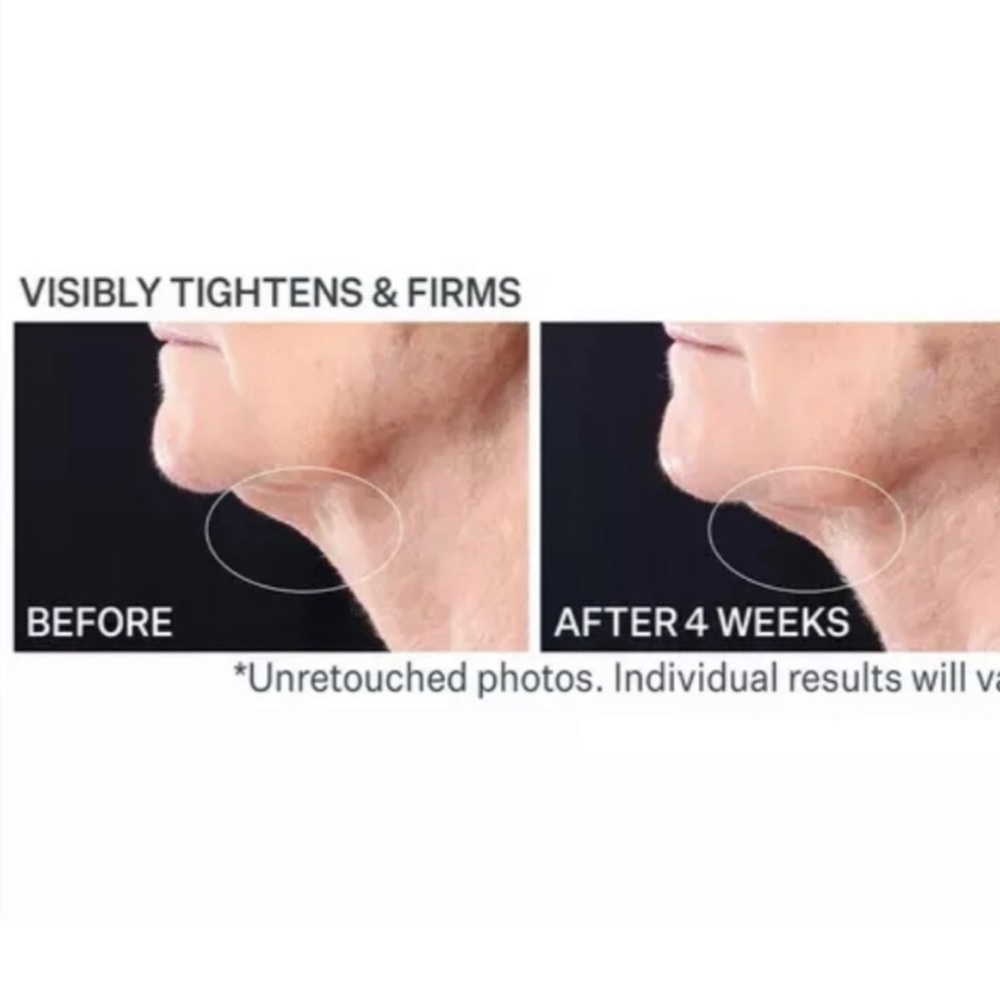BUNDLE StriVectin Peptight Tighten & Lift
Tightening Neck Serum Roller - Picture 8 of 8